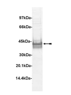 Eurofins DiscoverX LIM Kinase 1 Protein, Active 10 &mu;g | Buy Online | Eurofins DiscoverX | Fisher Scientific